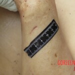 Chinese woman with severed carotid artery