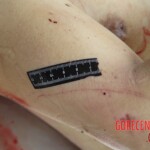 Chinese woman with severed carotid artery