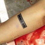 Chinese woman with severed carotid artery