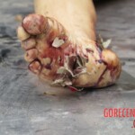 Chinese woman with severed carotid artery