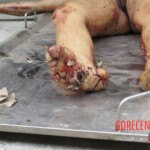 Chinese woman with severed carotid artery