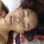Chinese woman with severed carotid artery