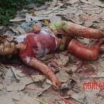 Chinese woman with severed carotid artery