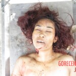 Chinese woman with severed carotid artery