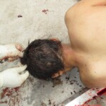Chinese woman with severed carotid artery