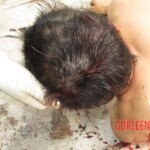 Chinese woman with severed carotid artery