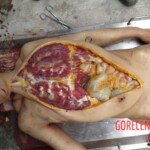 Chinese woman with severed carotid artery