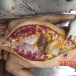 Chinese woman with severed carotid artery