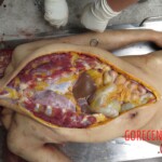 Chinese woman with severed carotid artery