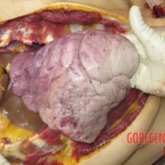 Chinese woman with severed carotid artery