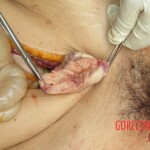 Chinese woman with severed carotid artery