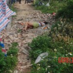 Chinese woman with severed carotid artery