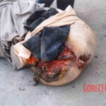 Disfigured Chinese woman wrapped in cloth and dumped on roadside