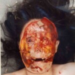 Disfigured Chinese woman wrapped in cloth and dumped on roadside