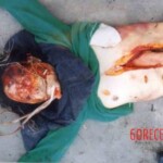 Disfigured Chinese woman wrapped in cloth and dumped on roadside