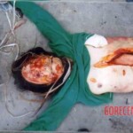 Disfigured Chinese woman wrapped in cloth and dumped on roadside