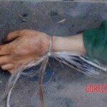 Disfigured Chinese woman wrapped in cloth and dumped on roadside