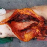 Disfigured Chinese woman wrapped in cloth and dumped on roadside