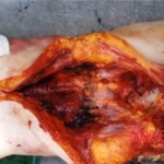 Disfigured Chinese woman wrapped in cloth and dumped on roadside