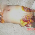 Dismembered woman found among garbage