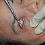 Examination of murdered Chinese woman