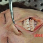 Examination of murdered Chinese woman