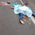 Female victim of hit & run collision