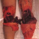 Japanese woman nearly tore her head off in suicide jump