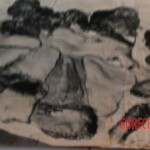 Skinned Brazilian woman in morgue