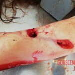 Stabbed woman in morgue