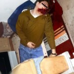 Suicide by firecracker in mouth