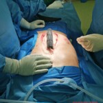 Surgery on patient who was injured in rodeo practice