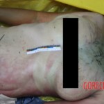 Teen Chinese girl found decomposing in woods