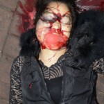 Young Chinese woman died in scooter crash