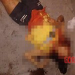 Young woman shot three times in head on street