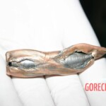 Arm wound caused by a .50cal bullet