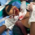 Doctors saved life of woman with slashed throat