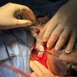 Doctors saved life of woman with slashed throat