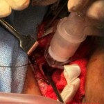 Doctors saved life of woman with slashed throat