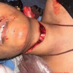 Doctors saved life of woman with slashed throat