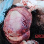 Field autopsy performed on young Chinese woman