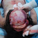 Field autopsy performed on young Chinese woman