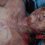 Field autopsy performed on young Chinese woman