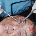 Field autopsy performed on young Chinese woman