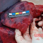 Field autopsy performed on young Chinese woman