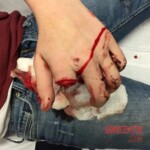 Finger bitten off by alligator snapping turtle