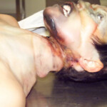 Hanged woman in morgue