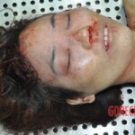 Initial examination of raped Chinese woman