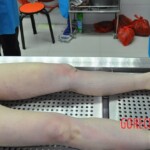 Initial examination of raped Chinese woman