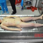 Initial examination of raped Chinese woman